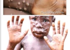 ‘Health Crisis,’ Gambia Declares Mpox Outbreak